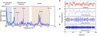 Low Frequency Systemic Hemodynamic “Noise” in Resting State BOLD fMRI: Characteristics, Causes, Implications, Mitigation Strategies, and Applications